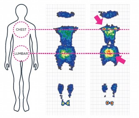 evaluation sleep impact of a mattress